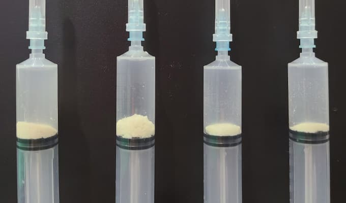 Calcific tendinitis treatment case 4 — before and after ultrasound